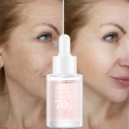 🎁Last Day Promotion 🎁-2025 Newest Niacinamide Pore Shrinking Moisturizing Anti-Wrinkle Serum